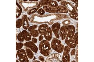 Immunohistochemical staining of human kidney with STARD10 polyclonal antibody  shows cytoplasmic and nuclear positivity in cells in tubules. (STARD10 anticorps)