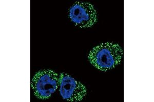 Immunofluorescence (IF) image for anti-Chemokine (C-C Motif) Receptor 7 (CCR7) antibody (ABIN5021834) (CCR7 anticorps)