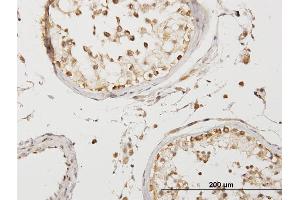 Immunoperoxidase of purified MaxPab antibody to COQ3 on formalin-fixed paraffin-embedded human testis.