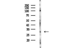 anti-Deleted in Lymphocytic Leukemia 1 (Non-Protein Coding) (DLEU1) (C-Term) antibody