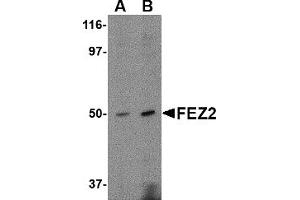 Western Blotting (WB) image for anti-Fasciculation and Elongation Protein zeta 2 (Zygin II) (FEZ2) (C-Term) antibody (ABIN1030393)