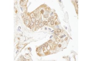Immunohistochemistry (IHC) image for anti-RAD9 Homolog A (S. Pombe) (RAD9A) (C-Term) antibody (ABIN7449007)