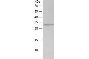 Western Blotting (WB) image for S100 Calcium Binding Protein A6 (S100A6) (AA 1-90) protein (His-IF2DI Tag) (ABIN7124960)