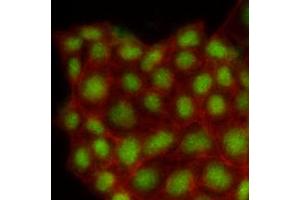 Immunofluorescence of human MCF7 cells stained with Phalloidin-TRITC (Red) for Actin staining and monoclonal anti-human MAPK1 antibody (1:500) with Alexa 488 (Green).
