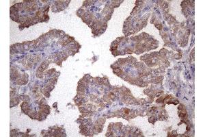 Immunohistochemistry (IHC) image for anti-Amelotin (AMTN) antibody (ABIN2716038)
