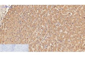 Immunohistochemistry of paraffin-embedded Human liver tissue using alpha Lactalbumin Monoclonal Antibody at dilution of 1:200. (LALBA anticorps)
