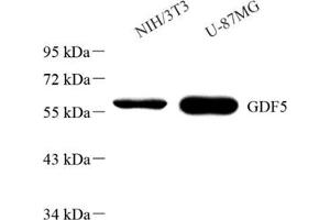 Western blot analysis of GDF5 (ABIN7074131)at dilution of 1: 1000
