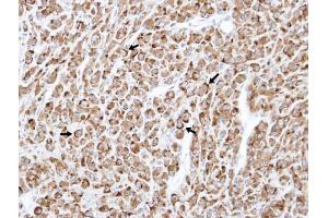 IHC-P Image Immunohistochemical analysis of paraffin-embedded U87 xenograft , using RELT, antibody at 1:100 dilution.