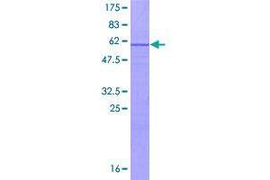 Image no. 1 for UTP11-Like, U3 Small Nucleolar Ribonucleoprotein (UTP11L) (AA 1-253) protein (GST tag) (ABIN1324853)