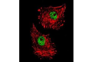 Confocal immunofluorescent analysis of FUS Antibody (C-term) (ABIN654146 and ABIN2844013) with MDA-M cell followed by Alexa Fluor 488-conjugated goat anti-rabbit lgG (green).