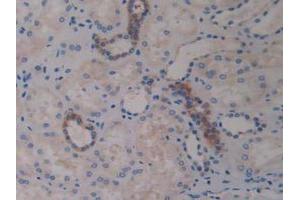 IHC-P analysis of Human Kidney Tissue, with DAB staining. (ADAM10 anticorps  (AA 420-641))