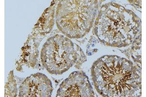 ABIN6269386 at 1/100 staining Mouse testis tissue by IHC-P. (BAD anticorps  (Internal Region))