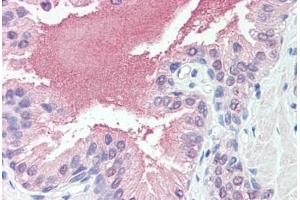 Anti-SLITRK6 antibody  ABIN960818 IHC staining of human prostate. (SLITRK6 anticorps  (Cytoplasmic Domain))