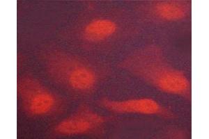 ABIN6267251 staining Hela cells by ICC/IF.