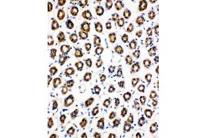 Anti-SDHC antibody, IHC(P) IHC(P): Rat Gaster Tissue (SDHC anticorps  (N-Term))