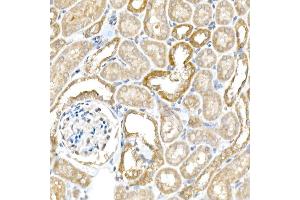 Immunohistochemistry of paraffin-embedded mouse kidney using B Rabbit pAb (ABIN6129977, ABIN6137413, ABIN6137415 and ABIN6220894) at dilution of 1:25 (40x lens). (BACE1 anticorps  (AA 22-322))