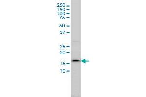 SSR4 monoclonal antibody (M01), clone 2D3 Western Blot analysis of SSR4 expression in C32 . (SSR4 anticorps  (AA 24-173))
