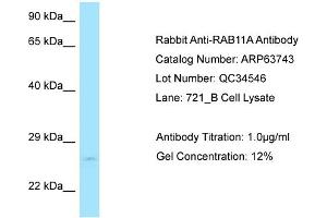Western Blotting (WB) image for anti-RAB11A, Member RAS Oncogene Family (RAB11A) (C-Term) antibody (ABIN2774380) (RAB11A anticorps  (C-Term))