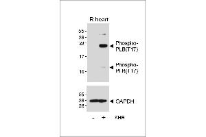 Western blot analysis of lysates from Rat heart tissue and spontaneous hypertensive (SHR) rat heart tissue lysate, using Phospho-PLB(T17) Antibody (ABIN650834 and ABIN2839801) (upper) or GDH (lower). (Phospholamban anticorps  (pThr17))