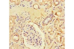 Immunohistochemistry of paraffin-embedded human kidney tissue using ABIN7176259 at dilution of 1:100 (ZNF366 anticorps  (AA 455-650))
