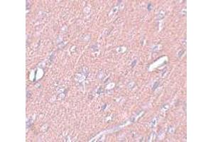 Immunohistochemistry (IHC) image for anti-Synaptogyrin 3 (SYNGR3) (C-Term) antibody (ABIN1030716) (Synaptogyrin 3 anticorps  (C-Term))
