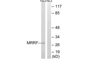 Western blot analysis of extracts from HeLa cells, using MRRF antibody. (MRRF anticorps  (C-Term))