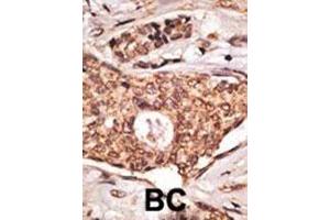 IHC analysis of FFPE human lymph node with ICOS antibody