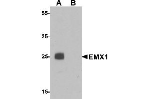 Western blot analysis of EMX1 in rat liver tissue lysate with EMX1 antibody at 1 µg/mL in (A) the absence and (B) the presence of blocking peptide. (EMX1 anticorps  (N-Term))