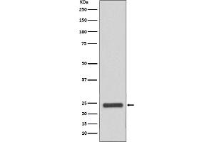 Western blot analysis of MRRF expression in HeLa cell lysate.
