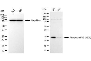 Western blotting analysis using phospho-eIF4E (S209) antibody (ABIN7798529). (Recombinant EIF4E anticorps  (pSer209))