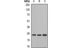 Western blot analysis of GSTM4 expression in SW480 (A), mouse liver (B), mouse lung (C) whole cell lysates. (GSTM4 anticorps)