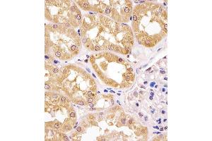 (ABIN6243533 and ABIN6578631) staining IP in human kidney tissue sections by Immunohistochemistry (IHC-P - paraformaldehyde-fixed, paraffin-embedded sections).
