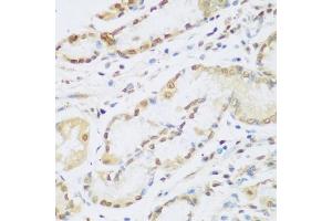 Immunohistochemistry of paraffin-embedded human stomach using CCND2 antibody (ABIN1875413) at dilution of 1:100 (40x lens). (Cyclin D2 anticorps)