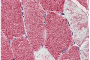 Human Skeletal Muscle: Formalin-Fixed, Paraffin-Embedded (FFPE) (POLG anticorps  (AA 829-1201))
