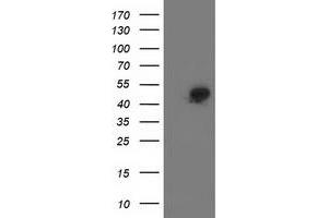 Western Blotting (WB) image for anti-Spermine Synthase, SMS (SMS) antibody (ABIN1501094) (SMS anticorps)