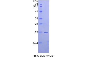 SDS-PAGE analysis of Rat a2PI Protein. (alpha 2 Antiplasmin Protéine)