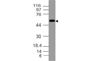 Image no. 1 for anti-Aldehyde Dehydrogenase 1 Family, Member A1 (ALDH1A1) (AA 284-492) antibody (ABIN5027017) (ALDH1A1 anticorps  (AA 284-492))