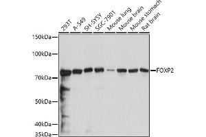 Western blot analysis of extracts of various cell lines, using FOXP2 antibody (ABIN6127914, ABIN6140762, ABIN6140763 and ABIN6221330) at 1:1000 dilution. (FOXP2 anticorps  (AA 441-740))