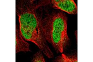 Immunofluorescent staining of U-2 OS with ARID1A polyclonal antibody  (Green) shows positivity in nucleus but excluded from the nucleoli. (ARID1A anticorps)