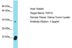 Host: Rabbit Target Name: TCF4 Sample Tissue: Human Uterus Tumor Antibody Dilution: 1ug/ml