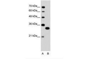 Image no. 1 for anti-Transcription Factor EC (TFEC) (AA 71-120) antibody (ABIN6736324) (TFEC anticorps  (AA 71-120))