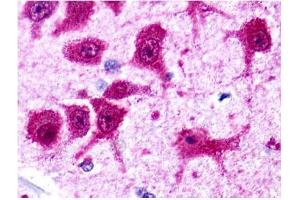 Brain, Neurons and glia (Metabotropic Glutamate Receptor 4 anticorps  (C-Term))