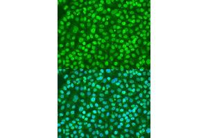 Immunofluorescence analysis of U2OS cells using BDNF antibody. (BDNF anticorps  (AA 20-247))