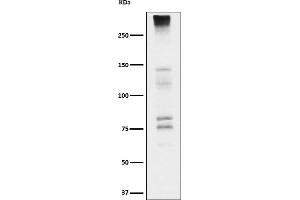 Western blot analysis of Neurocan expression in Fetal brain cell lysate.