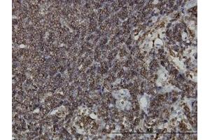 Image no. 1 for anti-Hematopoietic Cell-Specific Lyn Substrate 1 (HCLS1) (AA 266-356) antibody (ABIN598724) (HCLS1 anticorps  (AA 266-356))