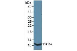 Western blot analysis of recombinant Mouse IL13Ra2. (IL13RA2 anticorps  (AA 228-338))