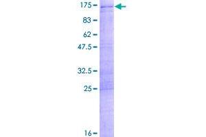 Image no. 1 for Squamous Cell Carcinoma Antigen Recognized By T Cells (SART1) (AA 1-800) protein (GST tag) (ABIN1319162)