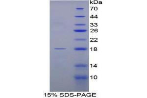 SDS-PAGE analysis of Rat FABP1 Protein. (FABP1 Protéine)