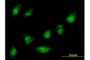 Immunofluorescence of purified MaxPab antibody to ZNF576 on HeLa cell. (ZNF576 anticorps  (AA 1-170))