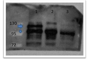 Western Blot of Rabbit anti-catenin ß-1 antibody Lane 1: zebrafish embryos injected with myc tagged catenin ß 1 mRNA Lane 2: zebrafish embryos injected with myc tagged catenin ß 2 mRNA Lane 3: zebrafish embryos un-injected Primary antibody: catenin ß-1 antibody at 1:500 overnight at 4°C Secondary antibody: goat anti-rabbit HRP at 1:10,000 for 1 hour at RT Predicted/Observed size: 85. (beta Catenin anticorps  (C-Term))